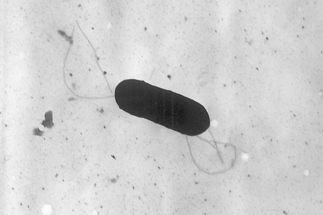 FILE - This 2002 electron microscope image made available by the Centers for Disease Control and Prevention shows a Listeria monocytogenes bacterium. Health officials have announced a recall of liverwurst and deli meat products, Friday, July 26, 2024, in connection with a national listeria outbreak that has sickened nearly three dozen people in 13 states. 