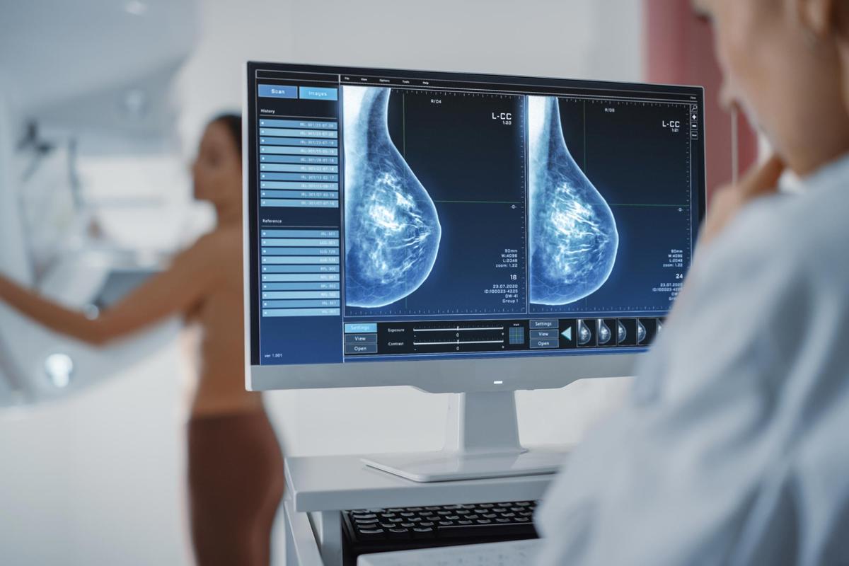 graphic breast exam MRI or X-ray